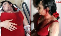 Komşuları trans bireyi beyzbol sopasıyla dövdü
